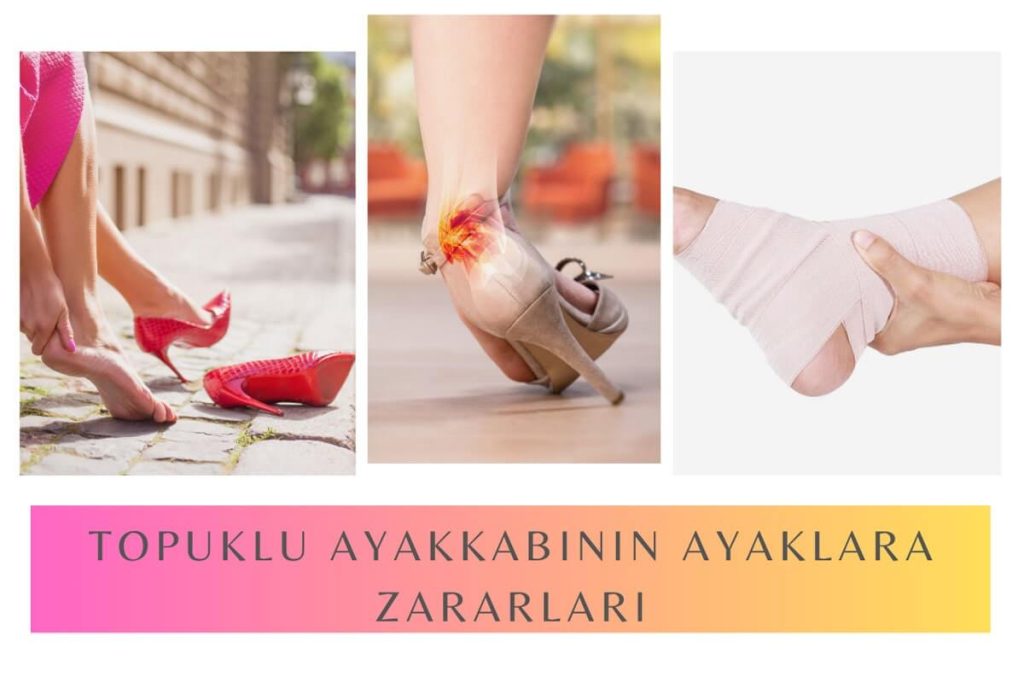Topuklu Ayakkabının Zararları